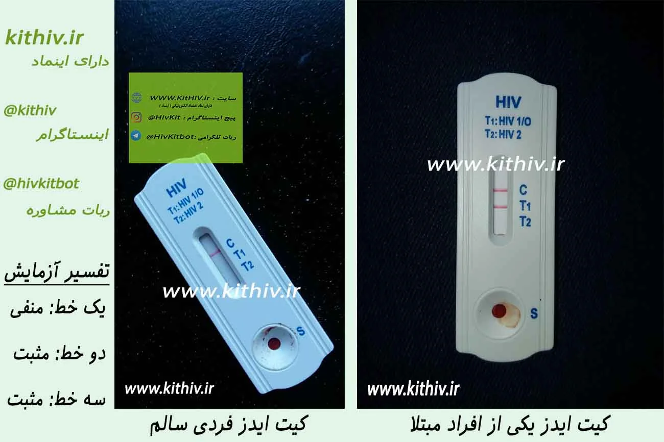 خرید کیت تشخیص ایدز