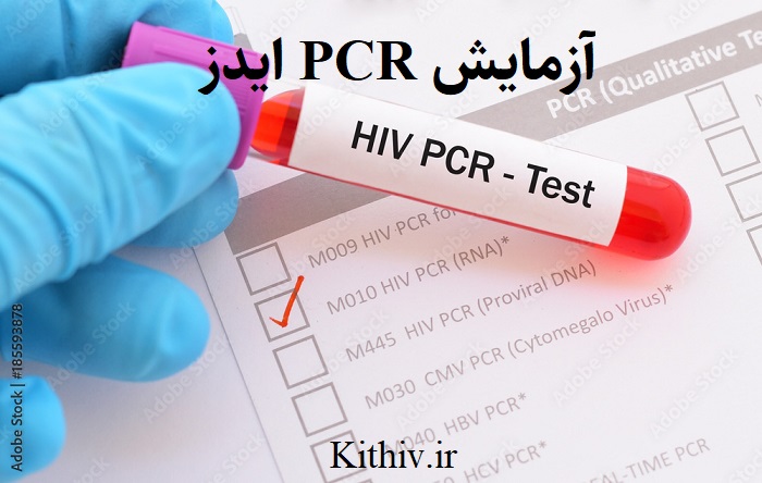 آزمایش PCR ایدز