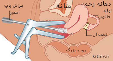 نحوه نمونه گیری آزمایش پاپ اسمیر