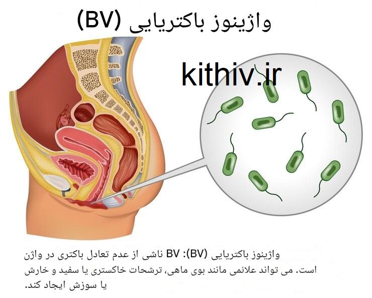 آیا رابطه مقعدی در بارداری خطر دارد