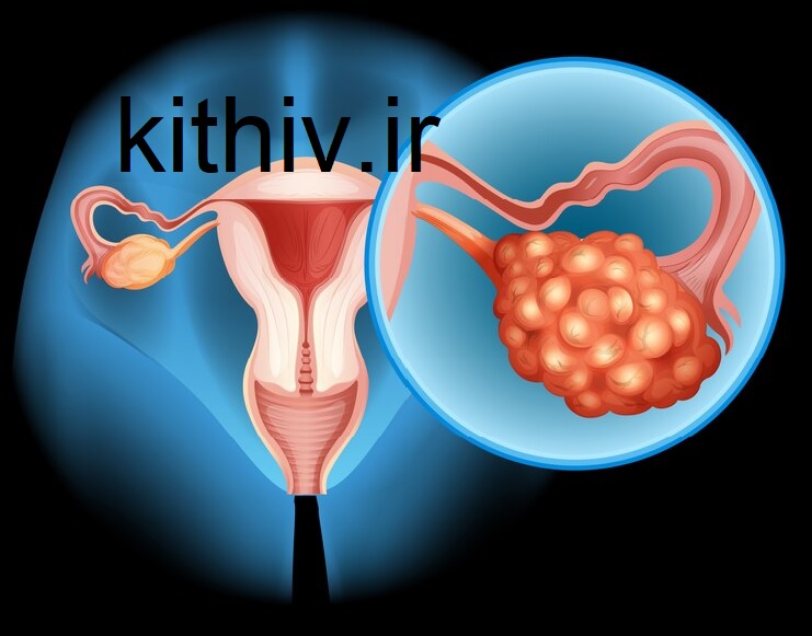 چرا رابطه دارم ولی باردار نمیشم