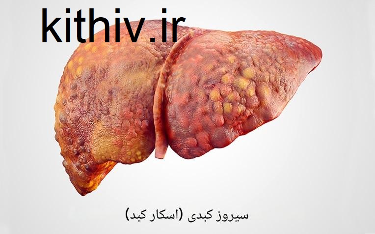 آیا هپاتیت c کشنده است