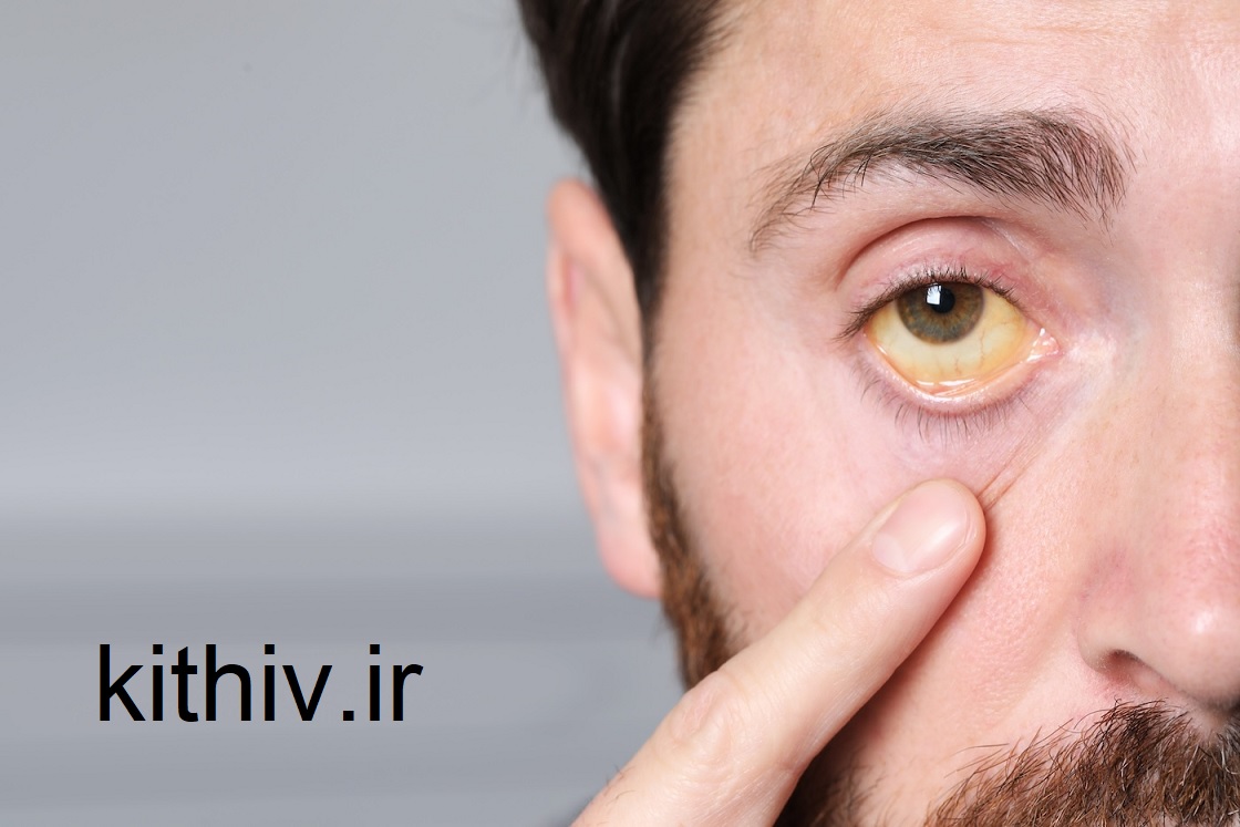 آیا هپاتیت اتوایمیون خطرناک است