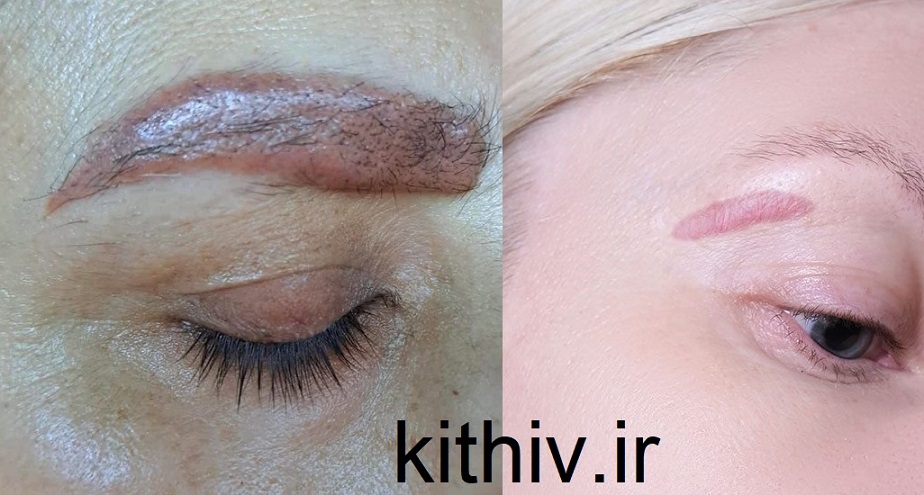میکروبلدینگ ابرو چیست