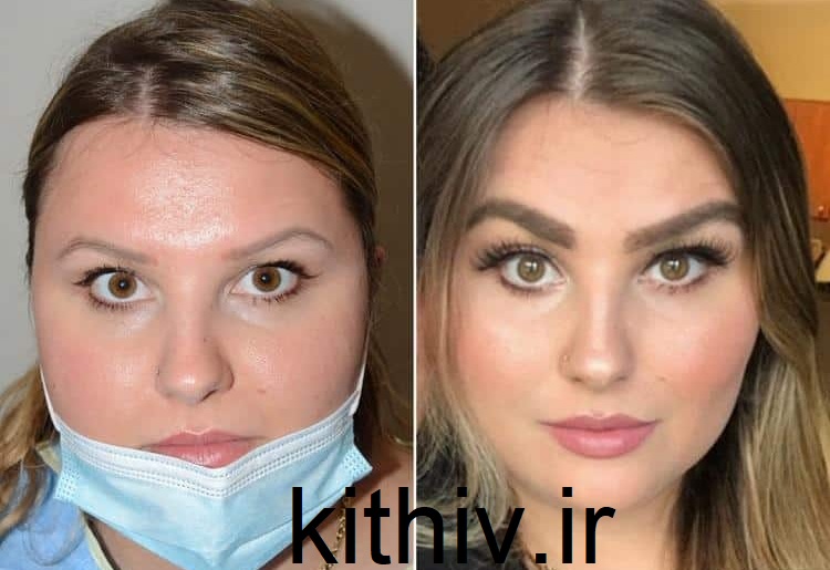 چگونه ابروهای پرپشت داشته باشیم