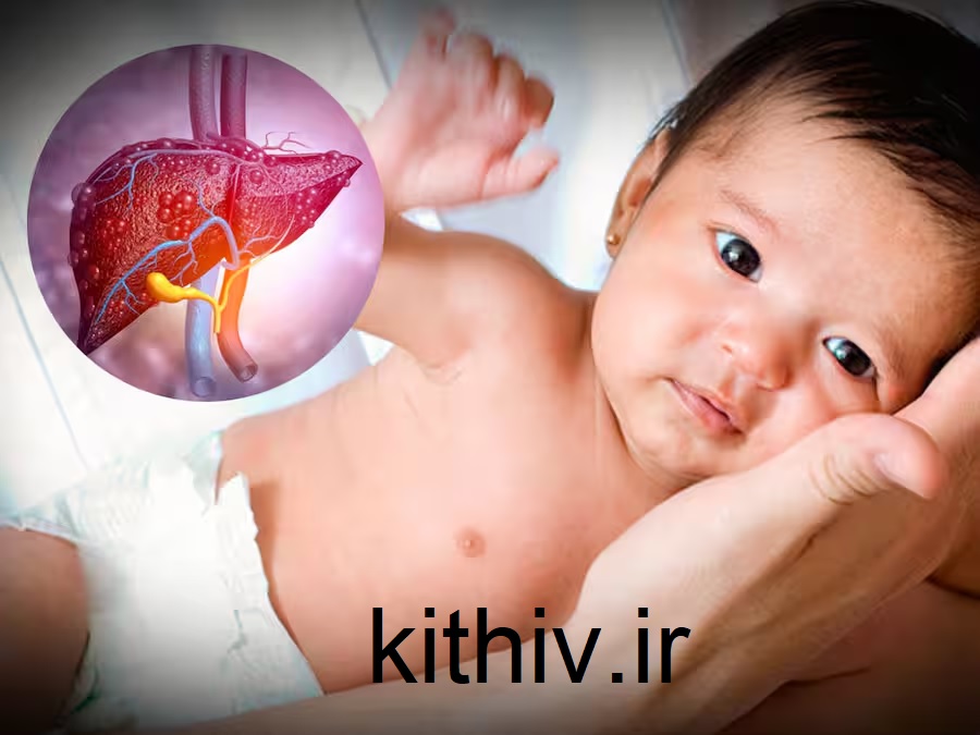Symptoms of hepatitis A in children