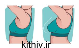 لیفت سینه بدون جراحی