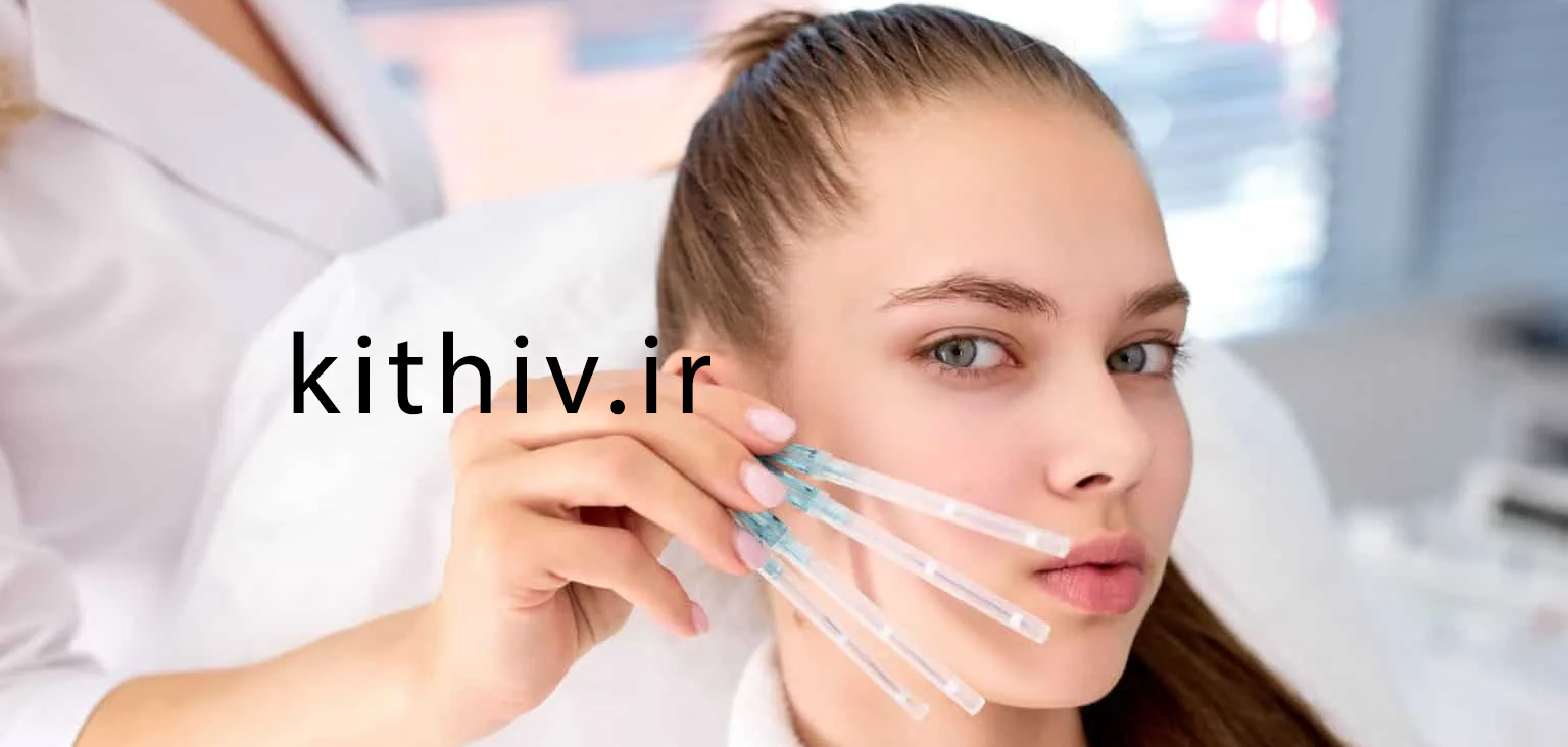 لیفت شقیقه با نخ