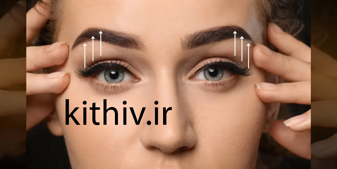 Eyebrow lift
