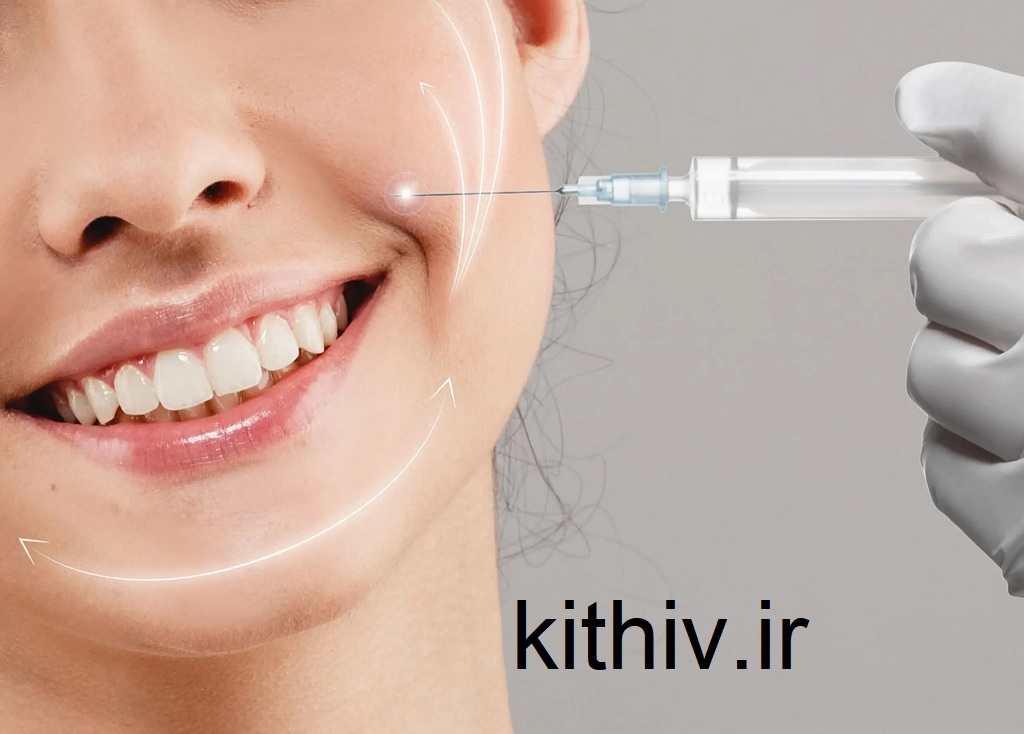 تزریق ژل برای خط خنده