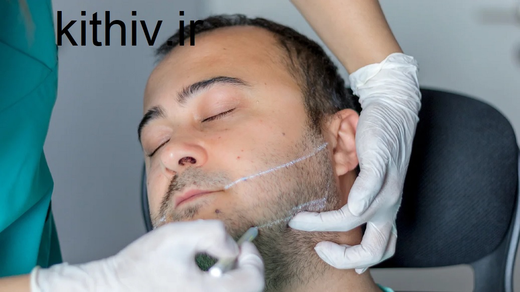 تزریق ژل زاویه فک