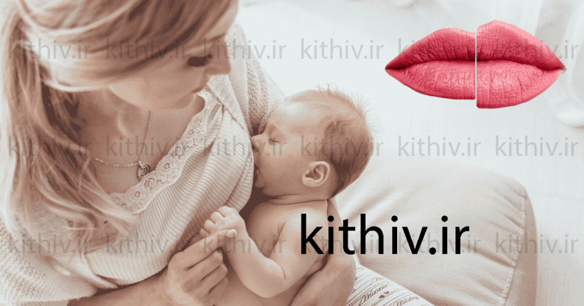 تزریق ژل در شیردهی