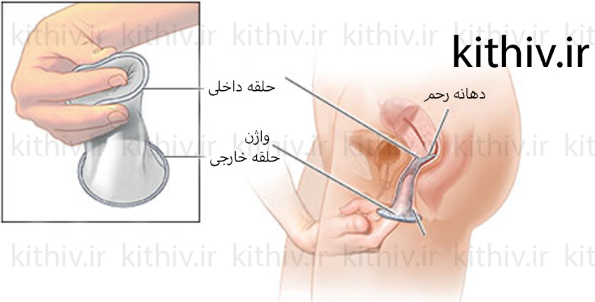 روش استفاده 