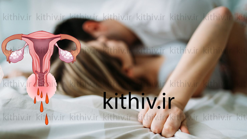 خونریزی بعد از رابطه