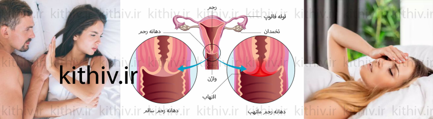 عوارض رابطه جنسی بیش از اندازه