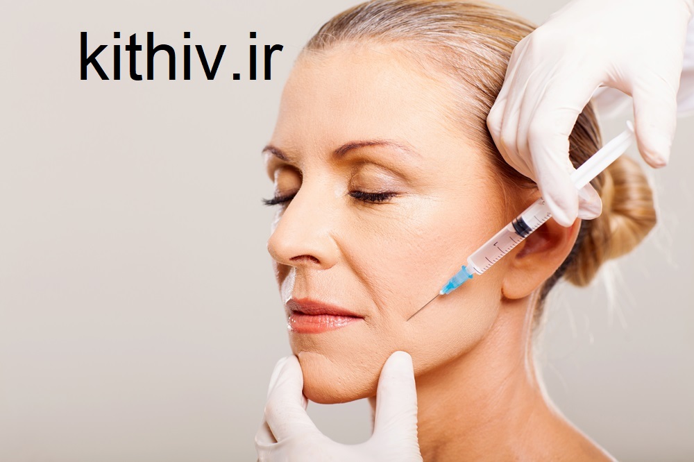 تزریق ژل برای خط خنده