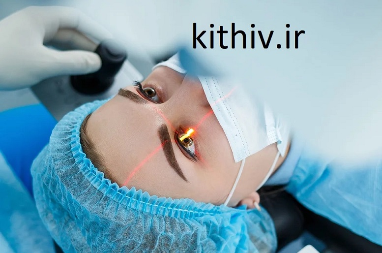 تغییر رنگ چشم 