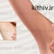 Underarm whitening
