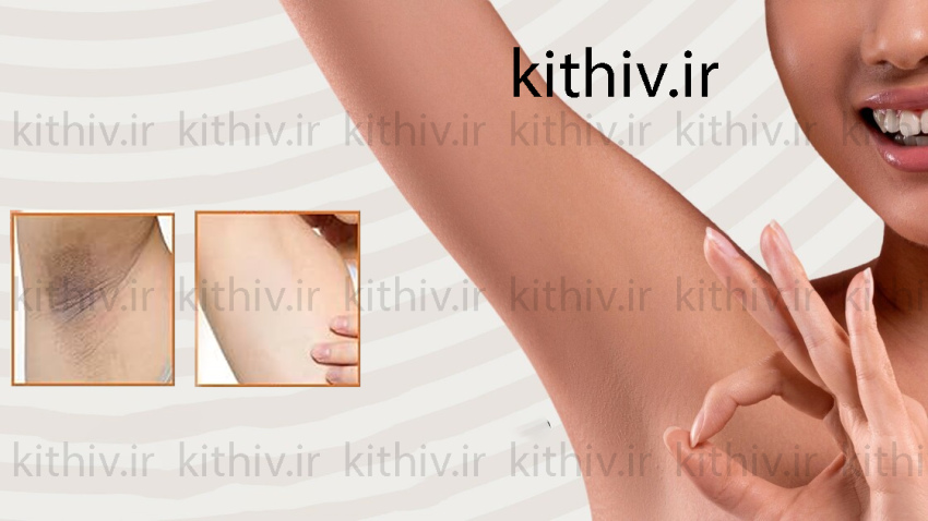 Underarm whitening