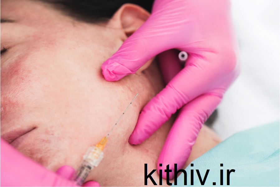 تزریق چربی برای جای جوش