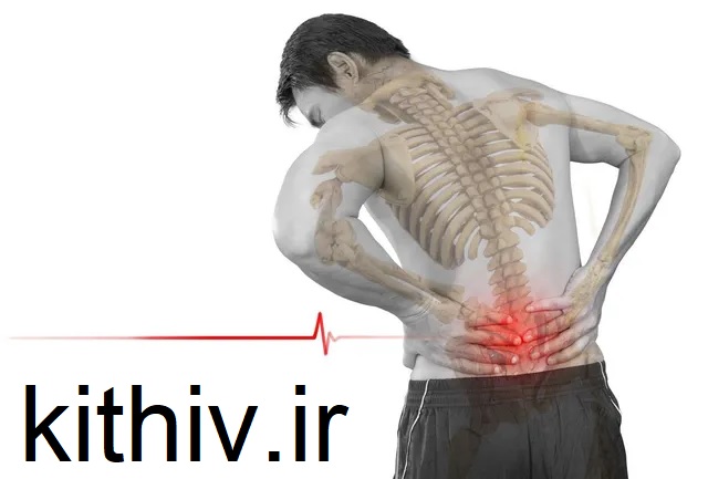 تزریق ژل برای دیسک کمر