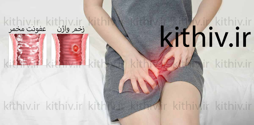 Vaginal Sex Complications