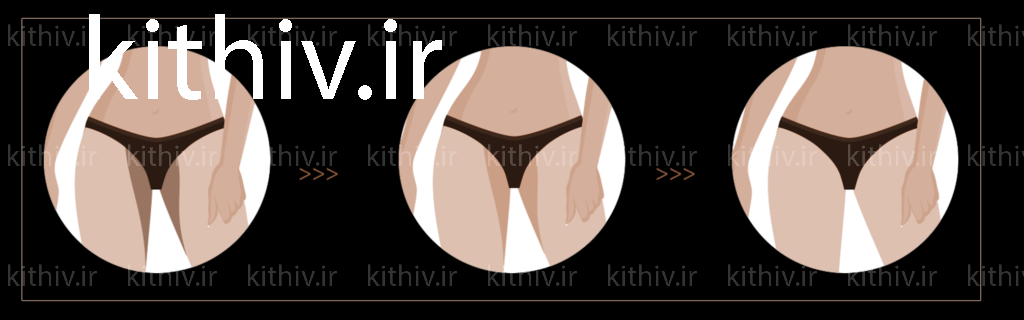 Vaginal whitening