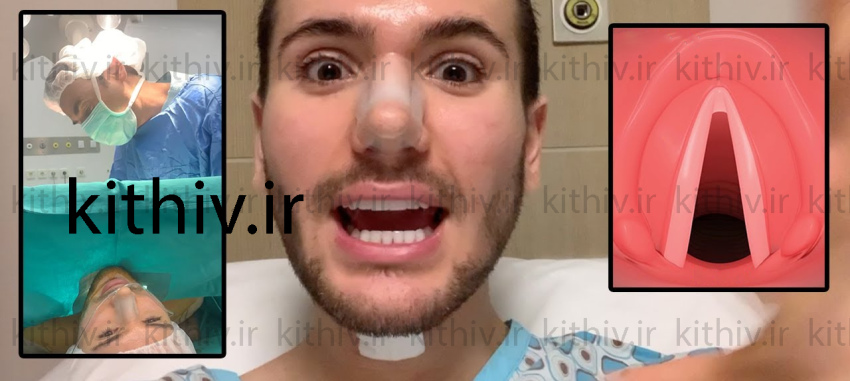 Vocal cord surgery to become masculine