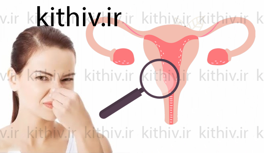 What causes bad vaginal odor