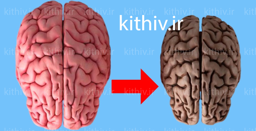 اثرات مشروبات الکلی روی مغز
