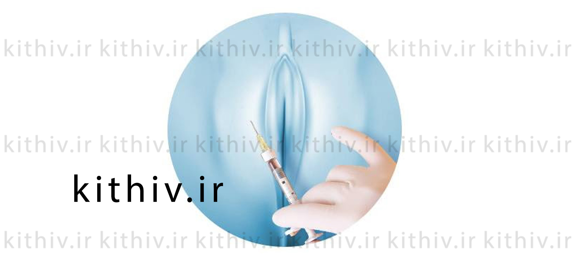 Bikini fat injection