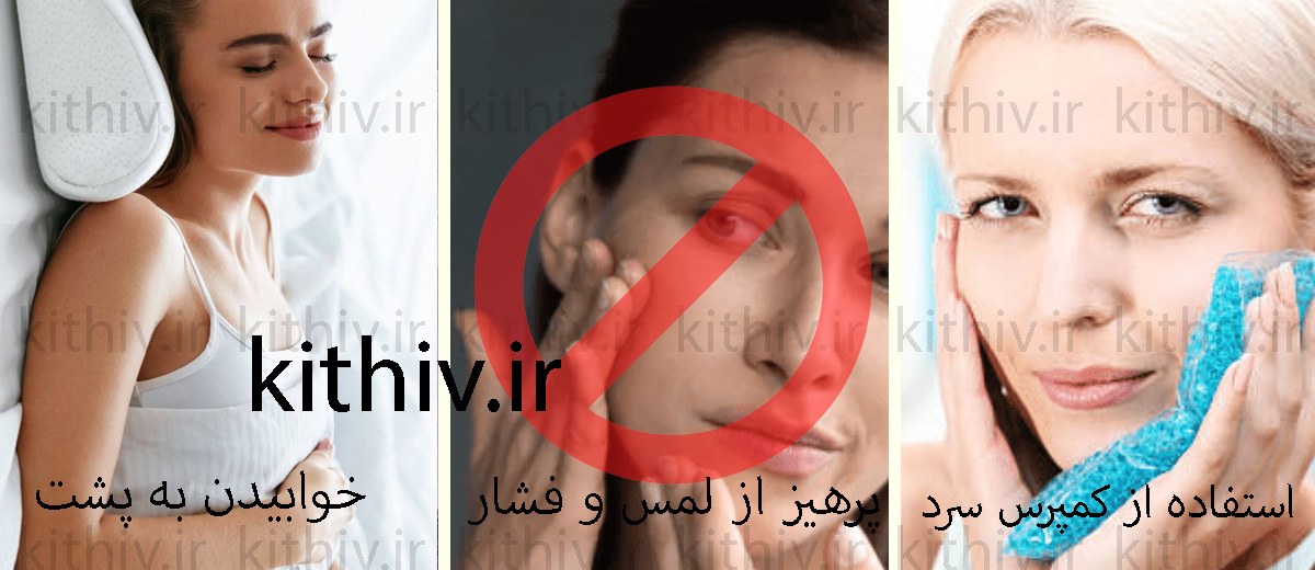 مراقبت های بعد از تزریق ژل