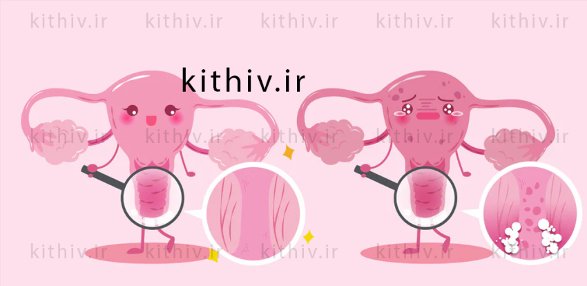 Treatment for vaginal itching