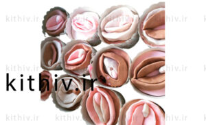 What does a change in vaginal color indicate