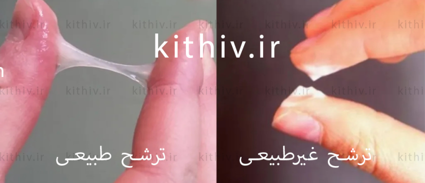 ترشح طبیعی و غیرطبیعی